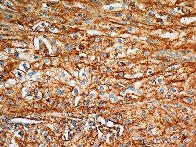 Immunohistochemistry-Paraffin: BST2 Antibody (2E2) - BSA Free [NBP2-29621]