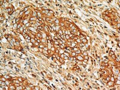 Immunohistochemistry-Paraffin: BST2 Antibody (2E2) - BSA Free [NBP2-29621]