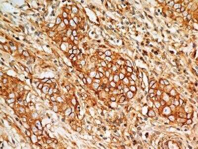 Immunohistochemistry: BST2 Antibody (4F6) - Azide and BSA Free [NBP2-80604]