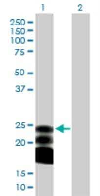 Western Blot: BST2 Antibody [H00000684-B02P]