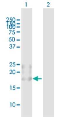 Western Blot: BST2 Antibody [H00000684-B02P]