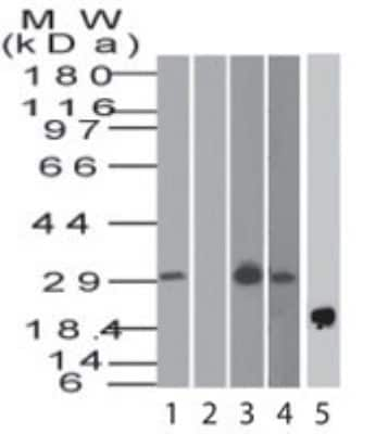 Western Blot: BST2 Antibody [NBP2-27154]