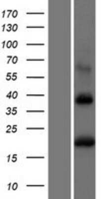 Western Blot: BST2 Overexpression Lysate [NBL1-08040]