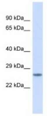 Western Blot: BSX Antibody [NBP3-10601]