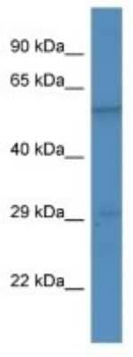 Western Blot: BSX Antibody [NBP3-10602]