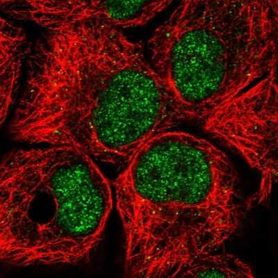 Immunocytochemistry/ Immunofluorescence: BTAF1 Antibody [NBP2-57414]