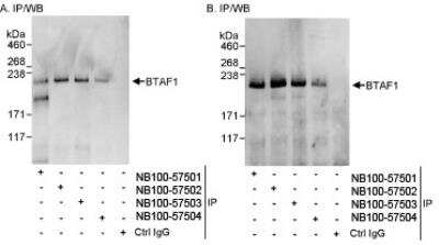 Immunoprecipitation: BTAF1 Antibody [NB100-57503]