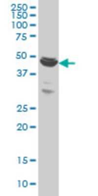 Western Blot: BTBD1 Antibody (3E11) [H00053339-M01]