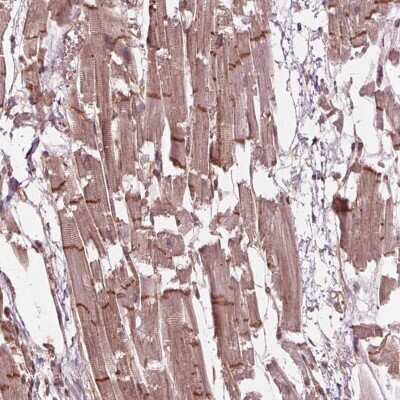 Immunohistochemistry: BTBD1 Antibody [NBP2-38109]