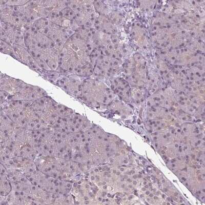 Immunohistochemistry-Paraffin: BTBD1 Antibody [NBP2-38109]