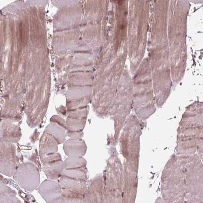 Immunohistochemistry-Paraffin: BTBD1 Antibody [NBP2-38109]