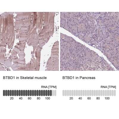 Immunohistochemistry-Paraffin: BTBD1 Antibody [NBP2-38109]