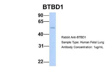 Western Blot: BTBD1 Antibody [NBP2-87087]