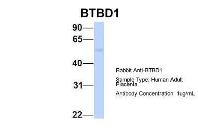 Western Blot: BTBD1 Antibody [NBP2-87087]