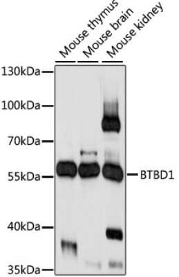 Western Blot: BTBD1 AntibodyAzide and BSA Free [NBP2-92210]