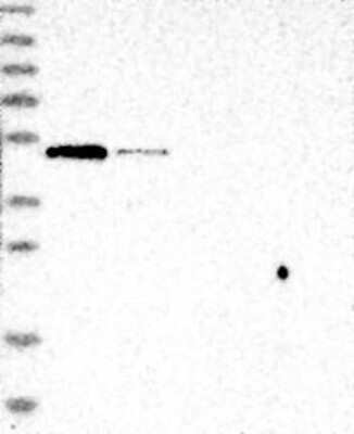 Western Blot: BTBD1 Antibody [NBP3-17690]