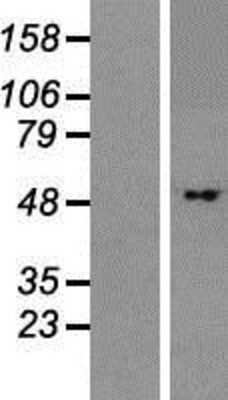 Western Blot: BTBD1 Overexpression Lysate [NBP2-06212]