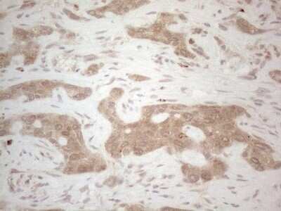 Immunohistochemistry: BTBD10 Antibody (OTI7D3) [NBP2-46584]