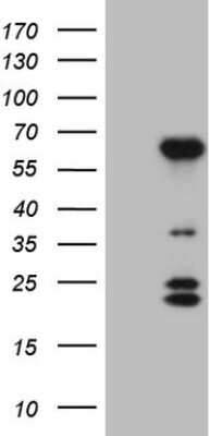 Western Blot: BTBD10 Antibody (OTI7D3) [NBP2-46584]