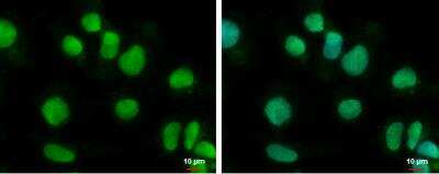 Immunocytochemistry/ Immunofluorescence: BTBD10 Antibody [NBP2-15625]