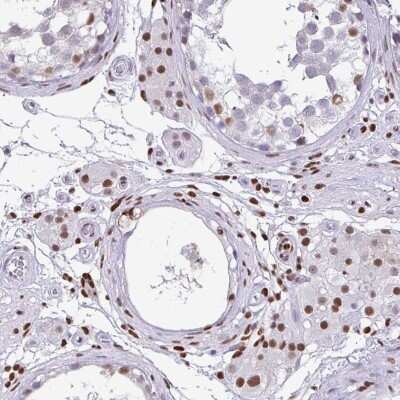 Immunohistochemistry: BTBD10 Antibody [NBP2-38558]