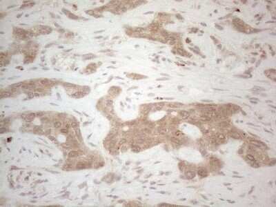 Immunohistochemistry: BTBD10 Antibody (OTI7D3) - Azide and BSA Free [NBP2-72293]