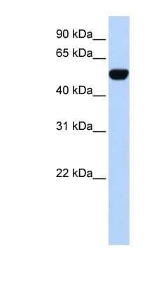 Western Blot: BTBD10 Antibody [NBP1-80088]