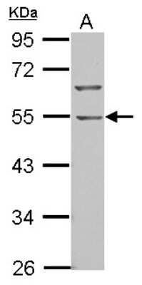 Western Blot: BTBD10 Antibody [NBP2-15625]