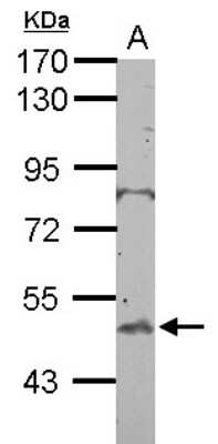 Western Blot: BTBD10 Antibody [NBP2-15625]