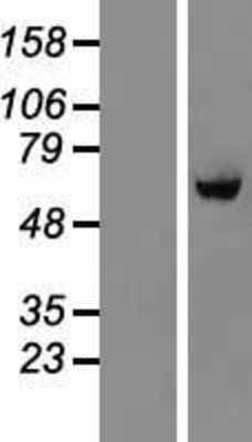 Western Blot: BTBD10 Overexpression Lysate [NBL1-08041]