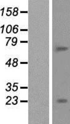 Western Blot: BTBD11 Overexpression Lysate [NBP2-05405]