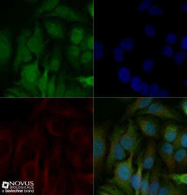 Immunocytochemistry/ Immunofluorescence: SLX4 Antibody - BSA Free [NBP1-28680]