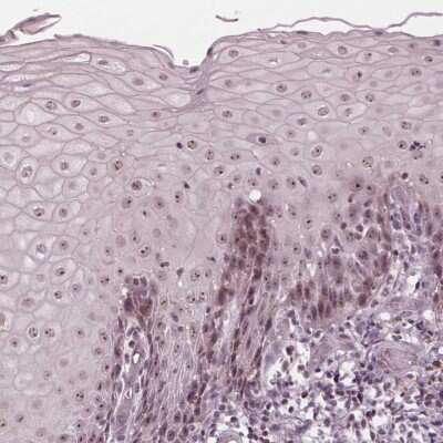 Immunohistochemistry: SLX4 Antibody [NBP2-39070]