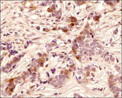 Immunohistochemistry-Paraffin: SLX4 Antibody - BSA Free [NBP1-28680]