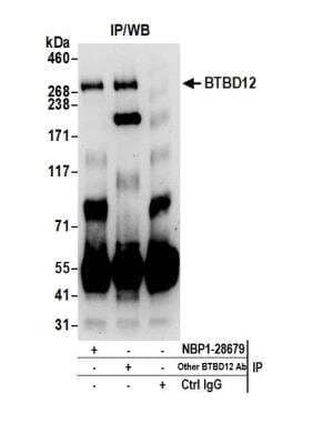 Immunoprecipitation: SLX4 Antibody [NBP1-28679]