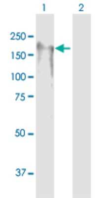 Western Blot: SLX4 Antibody [H00084464-B01P]