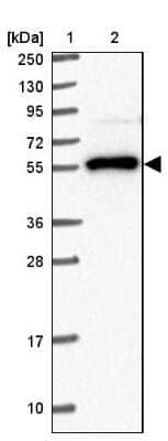 Western Blot: BTBD14A Antibody [NBP2-30579]