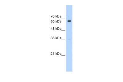 Western Blot: BTBD14A Antibody [NBP2-84518]