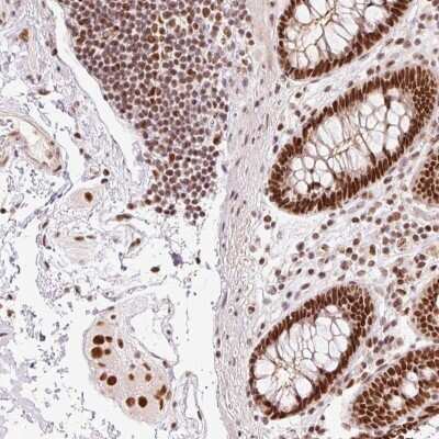 Immunohistochemistry: BTBD15 Antibody [NBP2-47539]