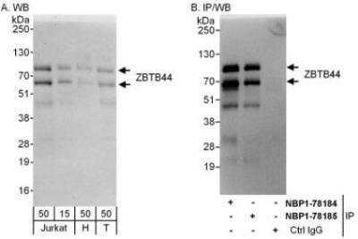 Western Blot: BTBD15 Antibody [NBP1-78184]