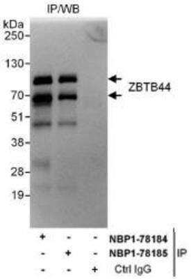 Western Blot: BTBD15 Antibody [NBP1-78185]