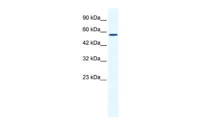 Western Blot: BTBD15 Antibody [NBP2-87089]