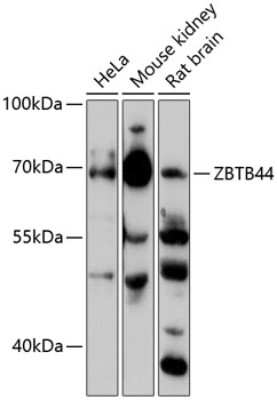 Western Blot: BTBD15 AntibodyAzide and BSA Free [NBP2-92109]