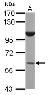 Western Blot: BTBD16 Antibody [NBP2-15626]