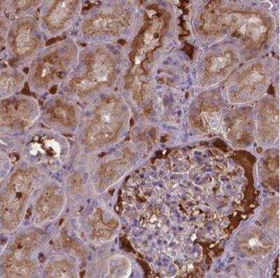 Immunohistochemistry-Paraffin: BTBD17 Antibody [NBP1-90749]