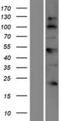 Western Blot: BTBD17 Overexpression Lysate [NBP2-08336]