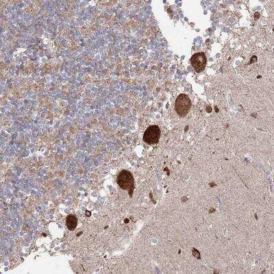 Immunohistochemistry-Paraffin: BTBD18 Antibody [NBP2-14677]