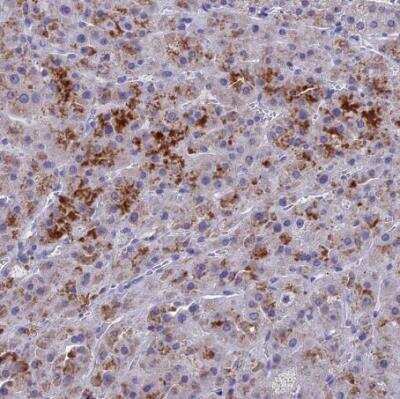 Immunohistochemistry-Paraffin: BTBD19 Antibody [NBP2-34178]