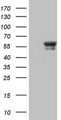 Western Blot: BTBD3 Antibody (OTI1A10) [NBP2-46585]