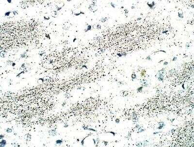 Immunohistochemistry-Paraffin: BTBD3 Antibody [NBP3-12291]